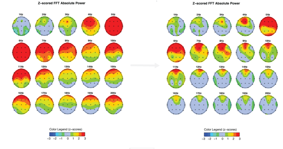 Brain Mapping Chart