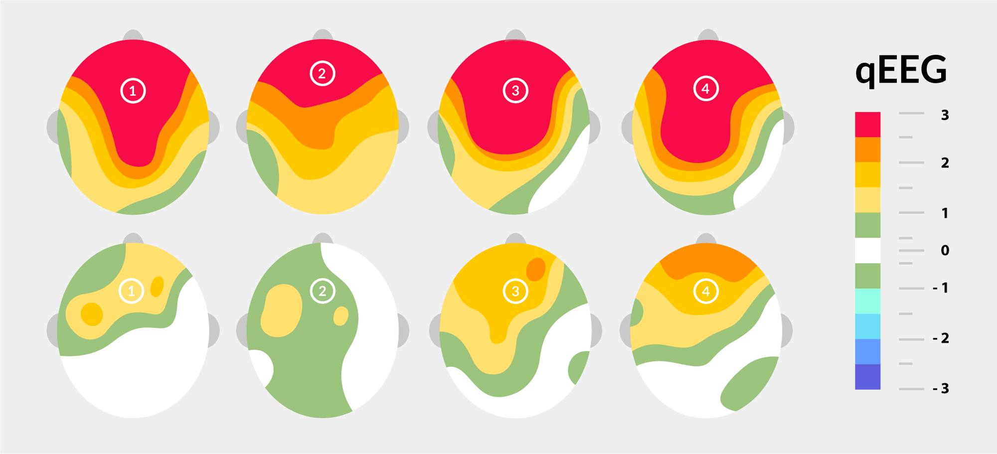 qEEG Brain Mapping